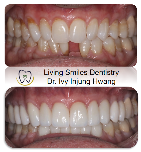 Cosmetic Dentist in Livingston