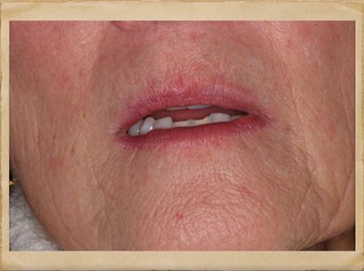 Cosmetic Dentist in Livingston