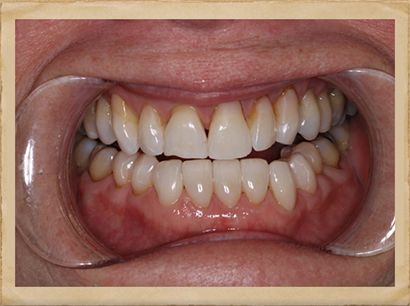 Best Dentist in Livingston