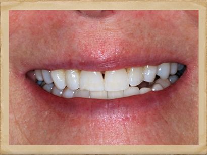 Emergency Dentist in Livingston