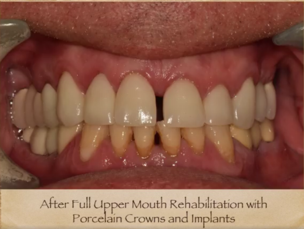 Best Dentist in Livingston