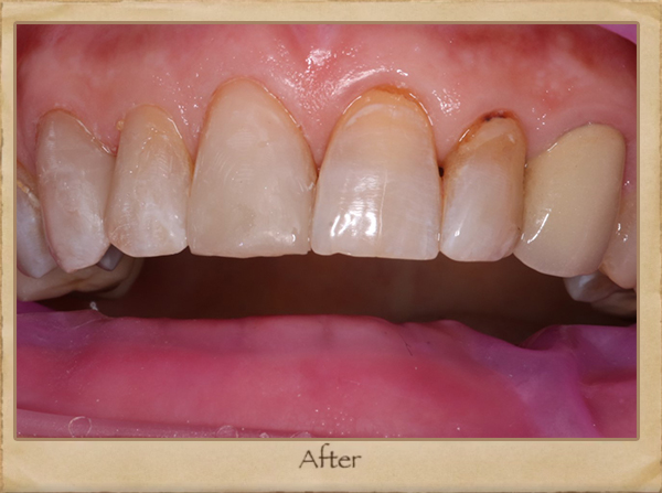 Cosmetic Dentist in Livingston