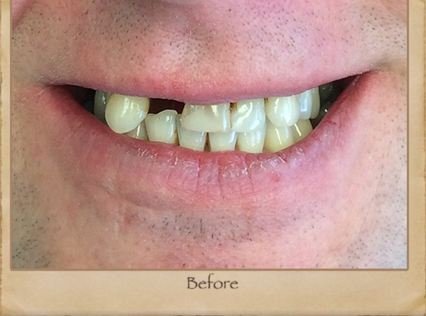 Emergency Dentist in Livingston