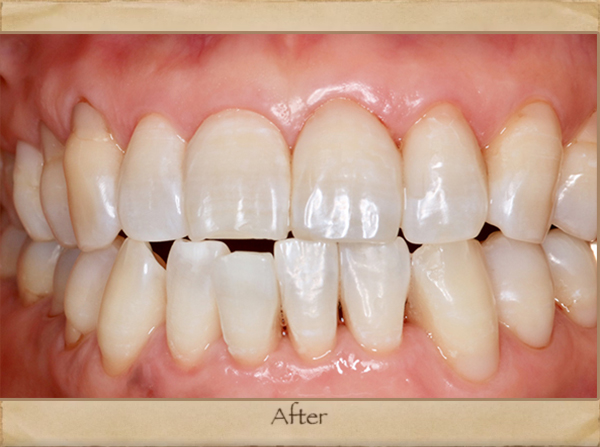 Best Dentist in Livingston