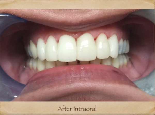 Cosmetic Dentist in Livingston