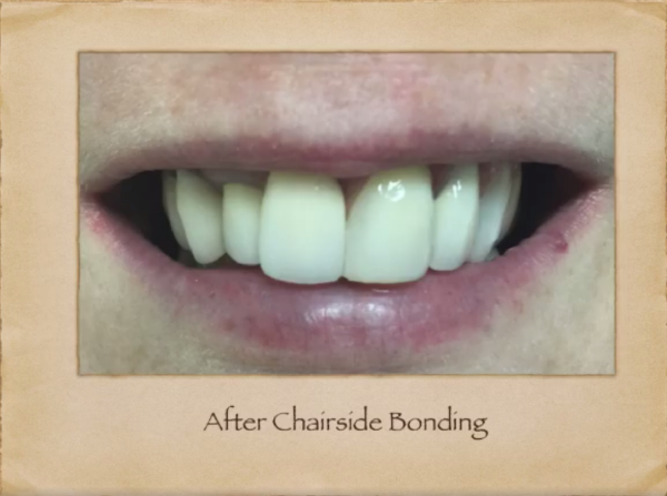 Emergency Dentist in Livingston