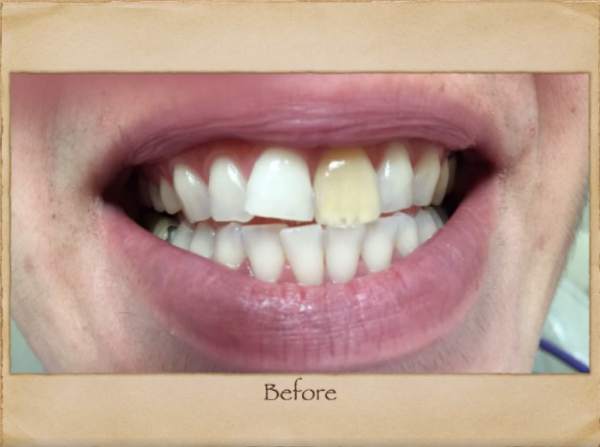 Emergency Dentist in Livingston