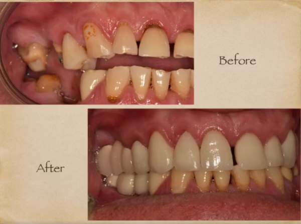 Cosmetic Dentist in Livingston