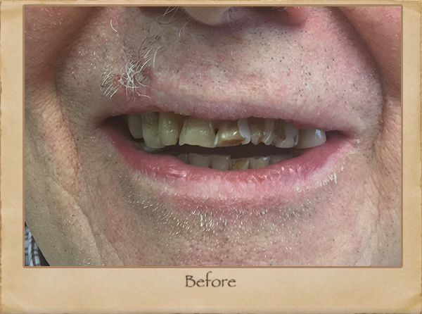 Best Dentist in Livingston