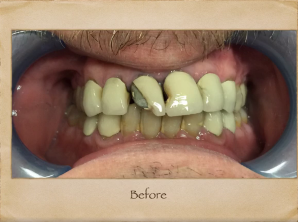 Emergency Dentist in Livingston