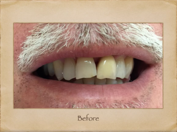 Emergency Dentist in Livingston