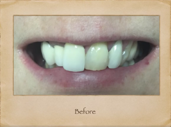 Livingston Family Dentist