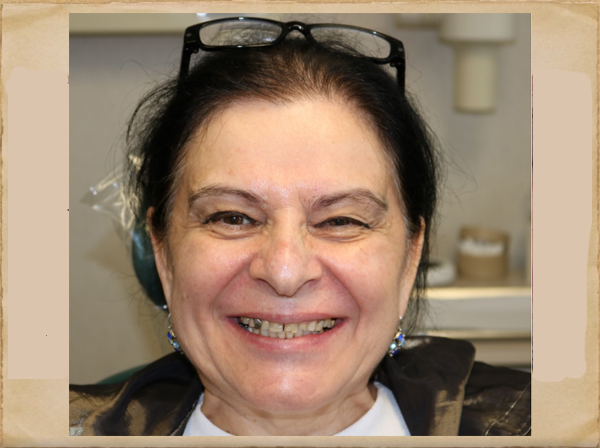 Cosmetic Dentist in Livingston