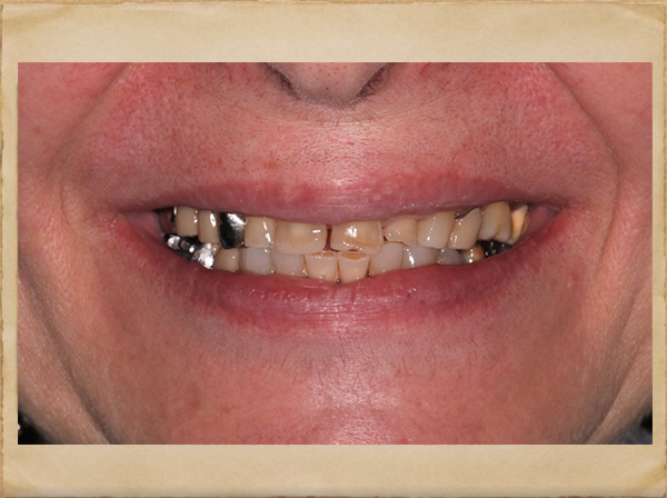 Best Dentist in Livingston