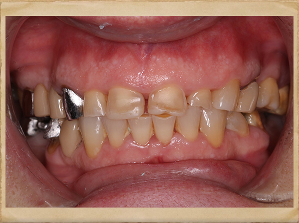 Best Dentist in Livingston