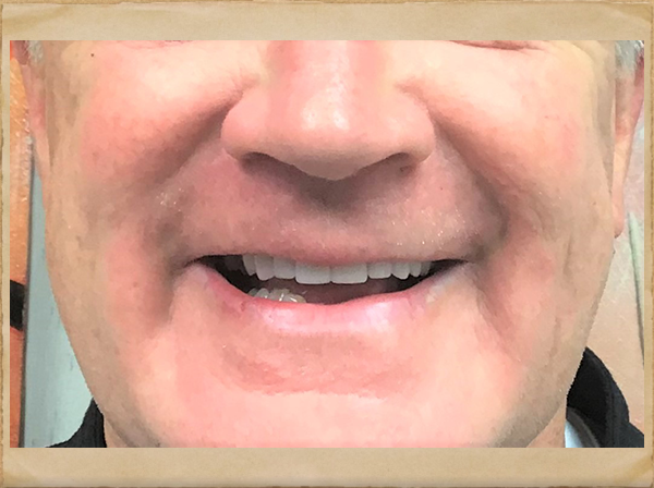 Living Smiles Dentistry | Dental Cleanings, Oral Exams and All-on-4 reg 