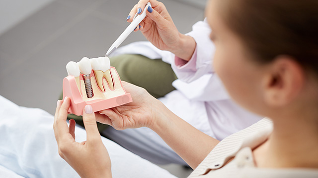 Implants Dentist in Livingston