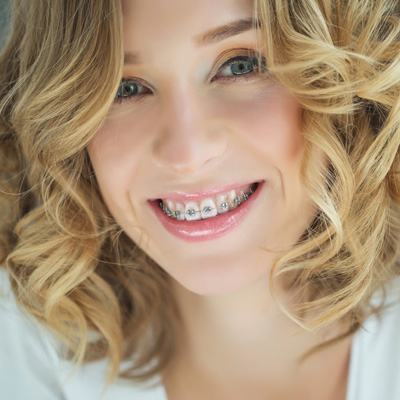 Living Smiles Dentistry | Invisalign reg , Air Abrasion and iTero reg  Intraoral Scanner
